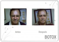 /album/fotogaleria-fotogaleria/a2-jpg1/
