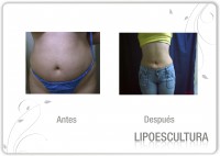 /album/fotogaleria-fotogaleria/a8-jpg/